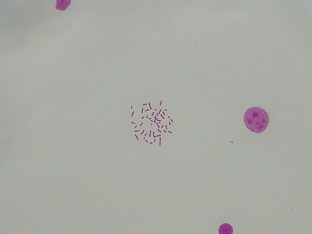 Male Chromosomes Slides - Male Chromosomes 07 400X